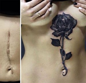 Cicatrice et tatouage : véritable travail d’artiste !