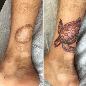 Cicatrice et tatouage : véritable travail d’artiste !